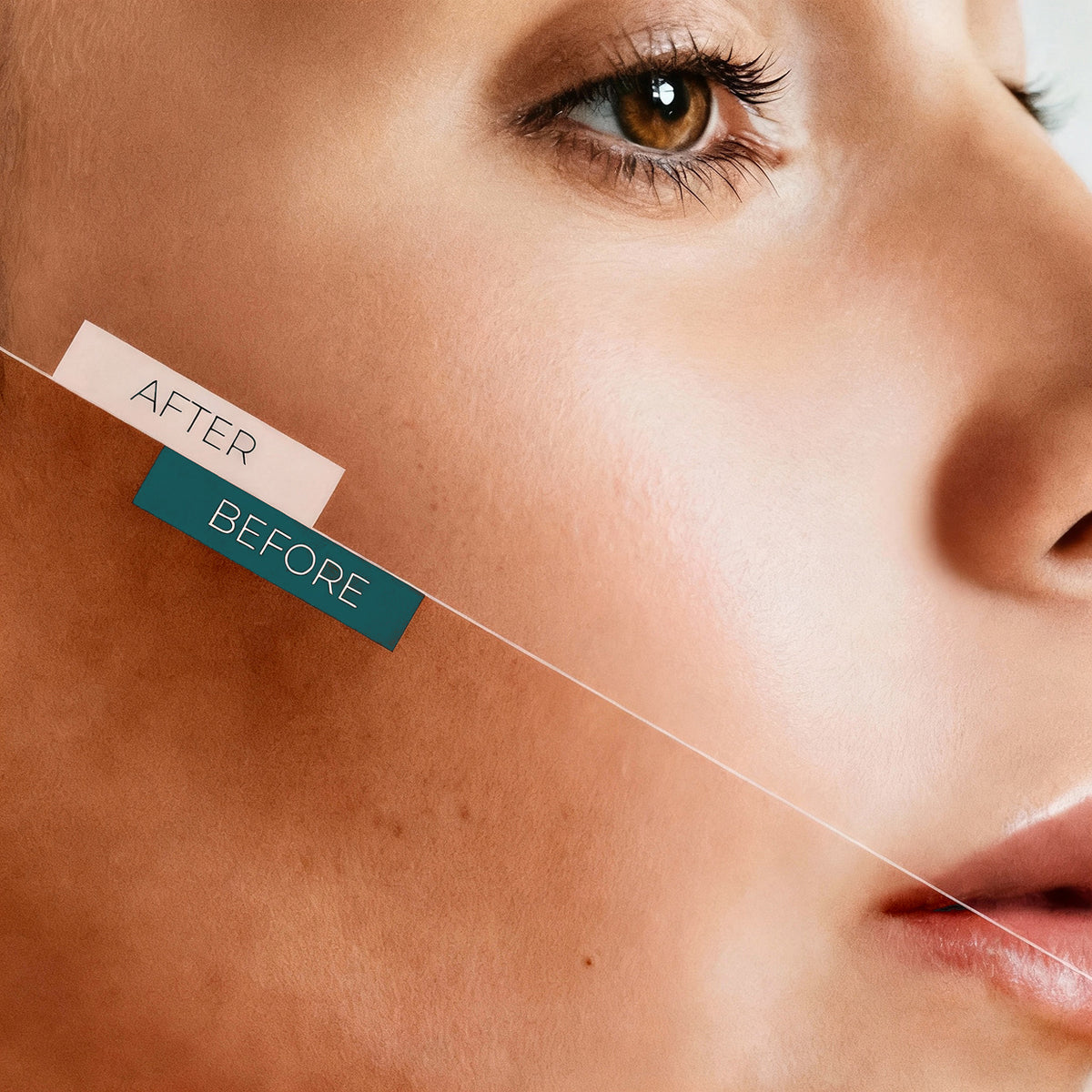 سيروم تفتيح التصبغات